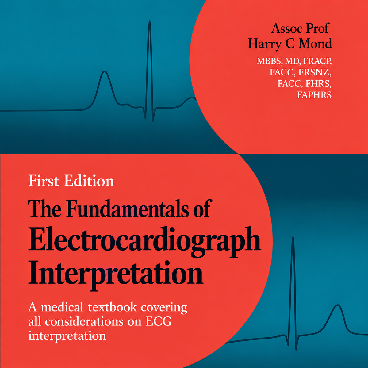 The fundamentals of ECG interpretation