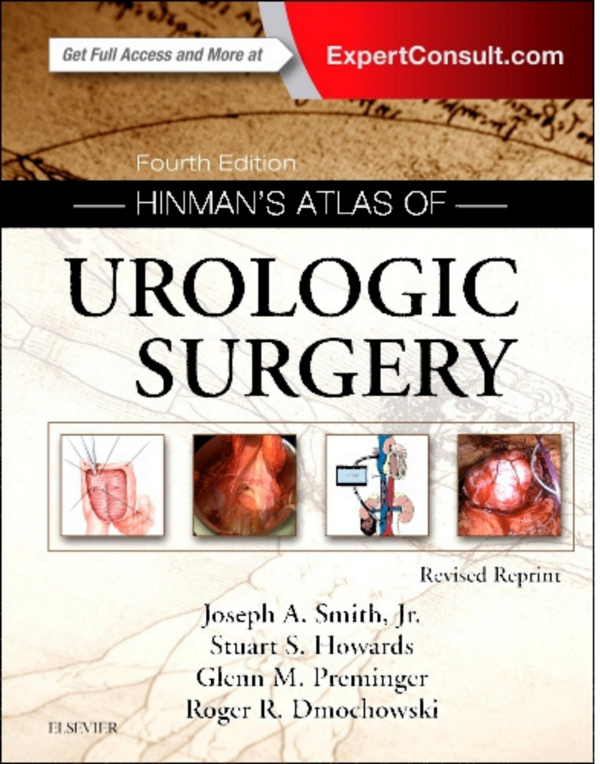 Hinman’s atlas of urologic surgery 4e 995