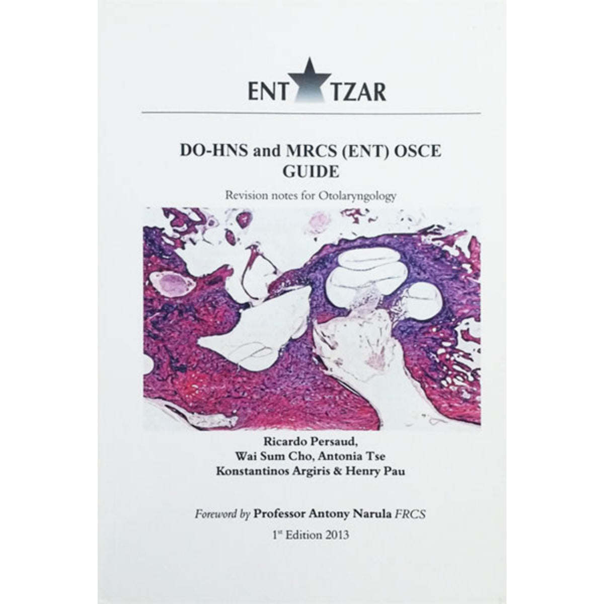ENT TZAR OSCE guide