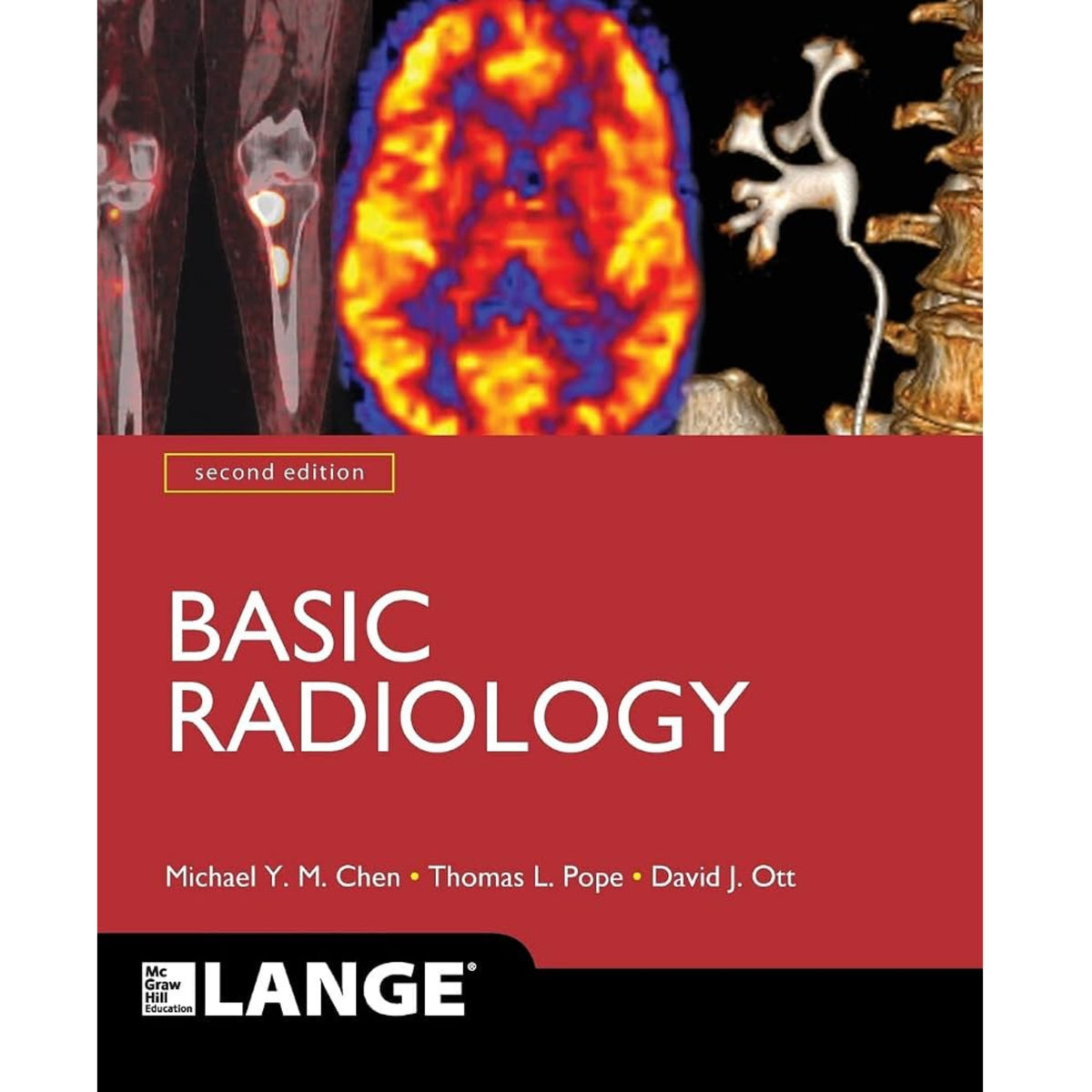 Basic radiology 2e