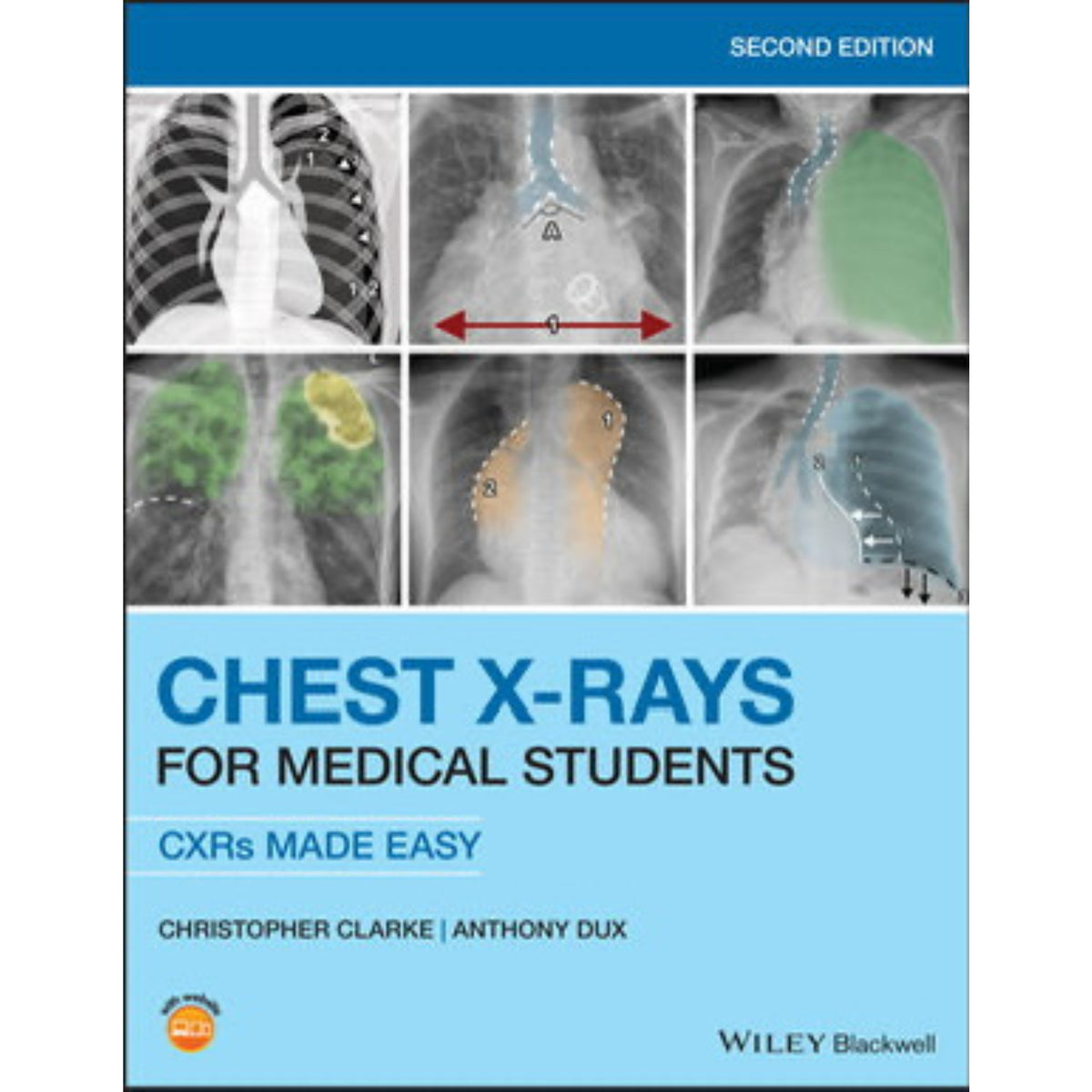 Chest Xrays for medical students 2e