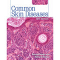 Common skin diseases 18e