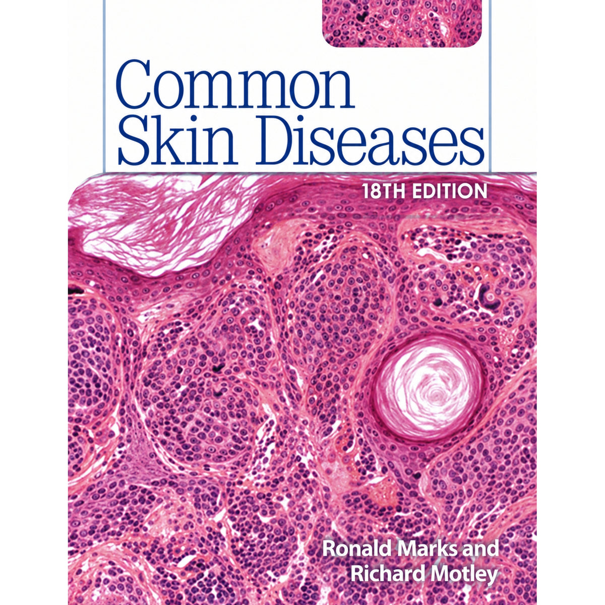 Common skin diseases 18e