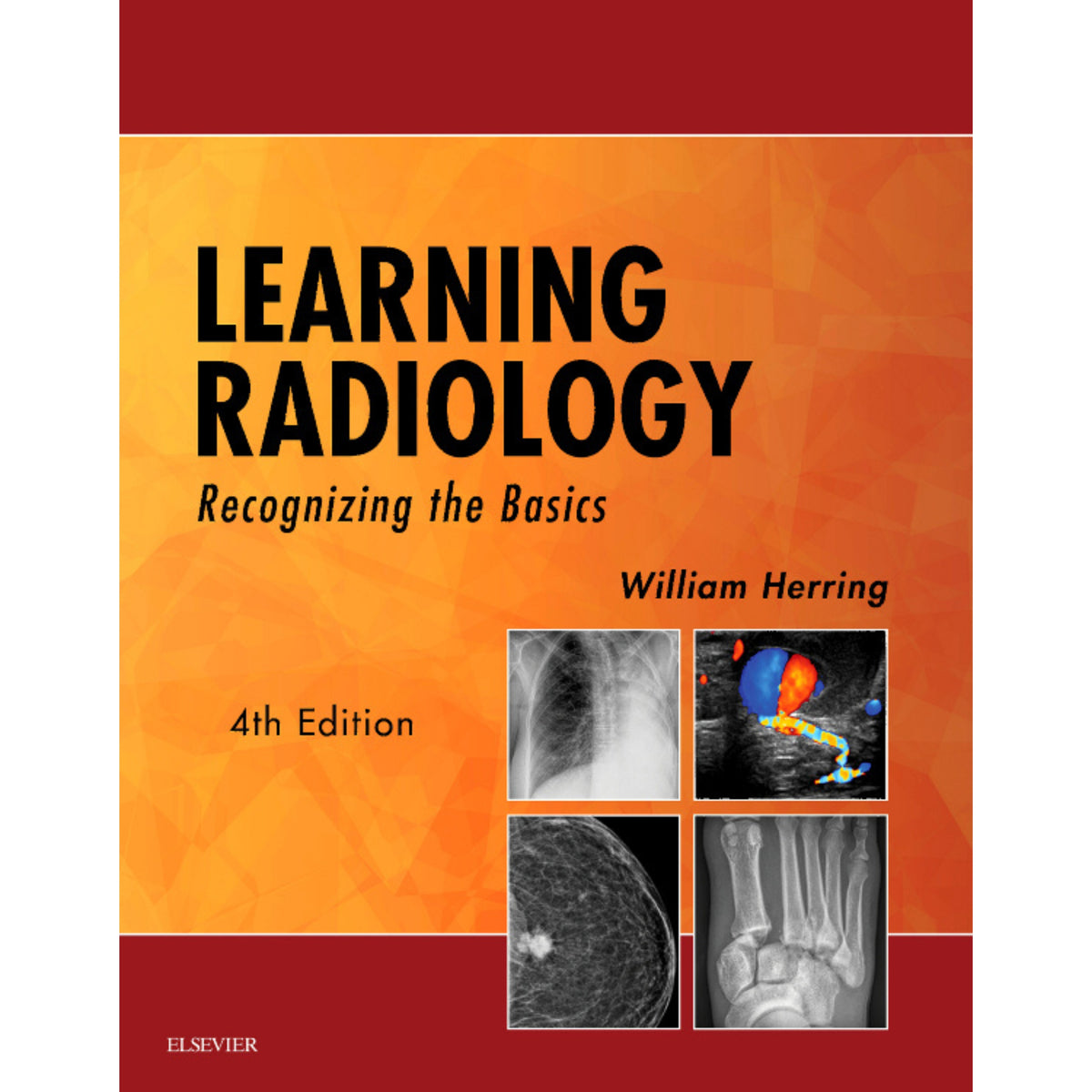Learning radiology 4e