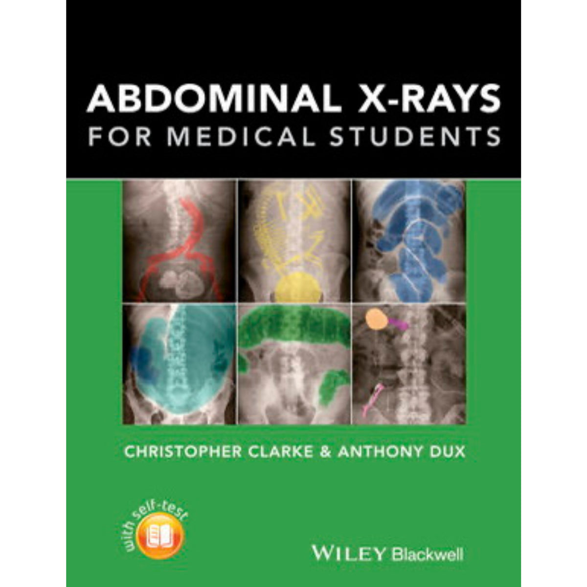 Abdominal Xrays for medical students