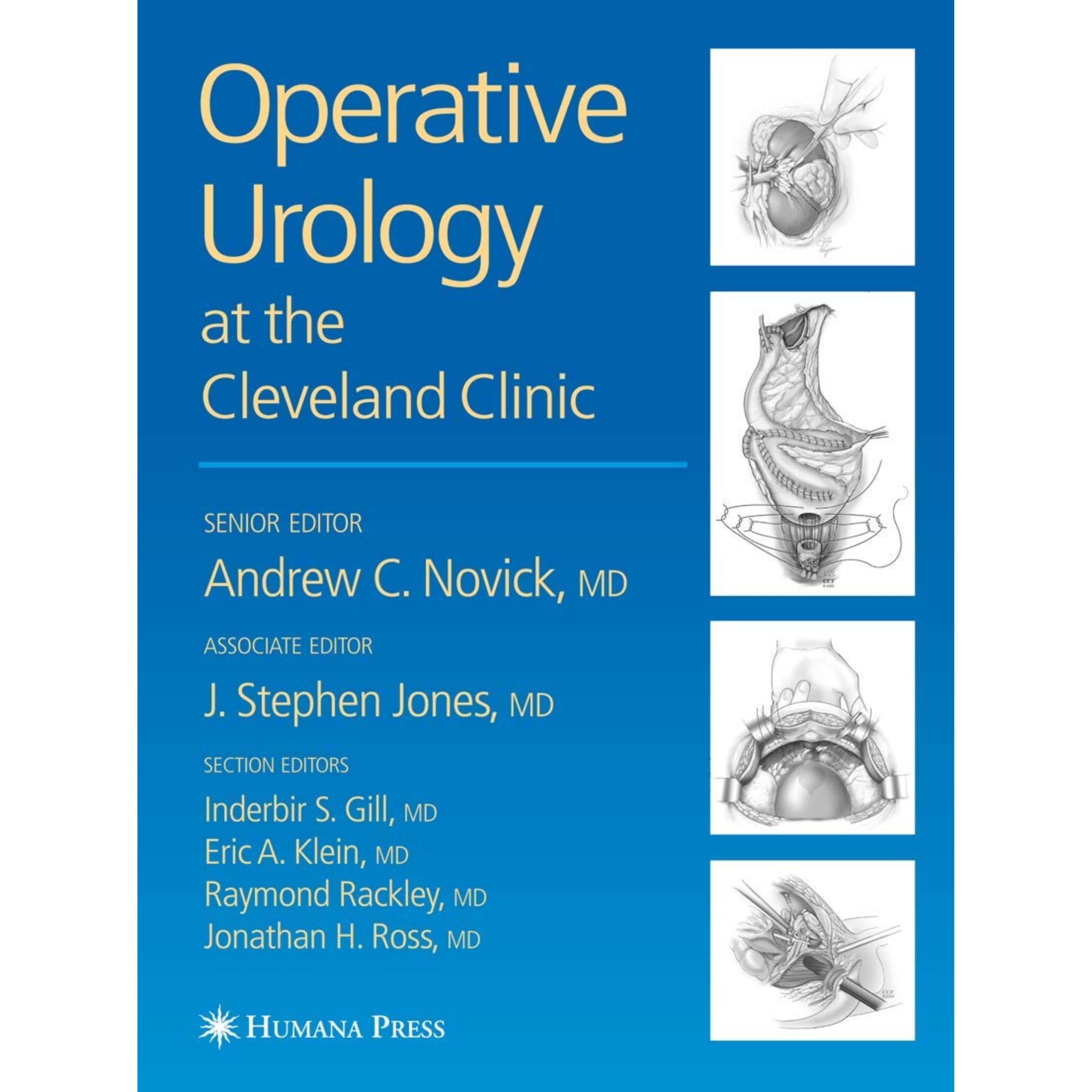 Operative urology