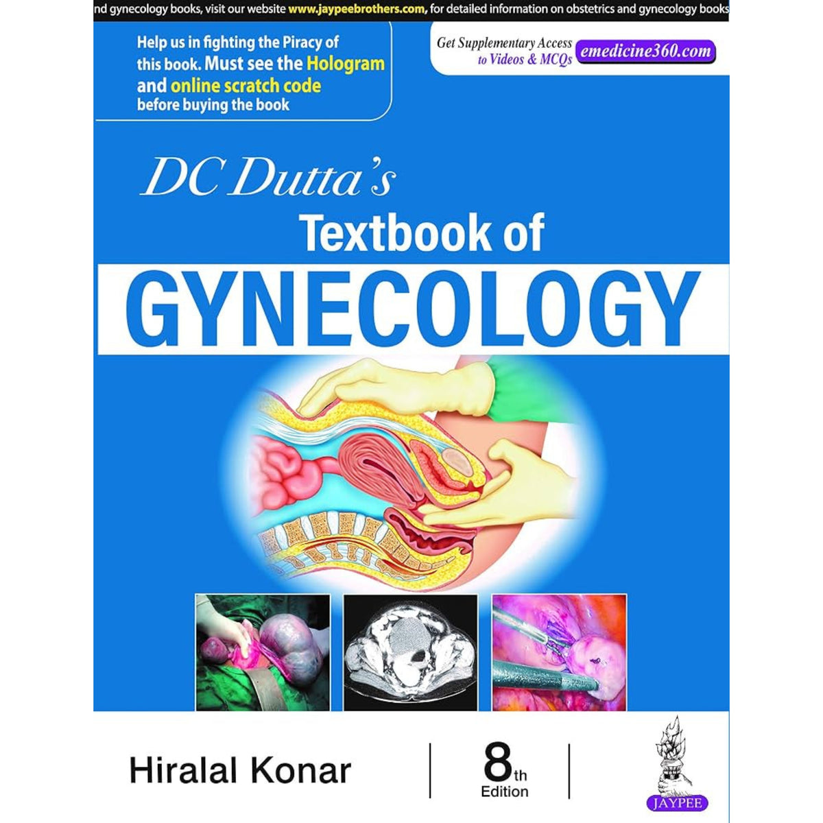 DC dutta textbook of gynecology 8e 606