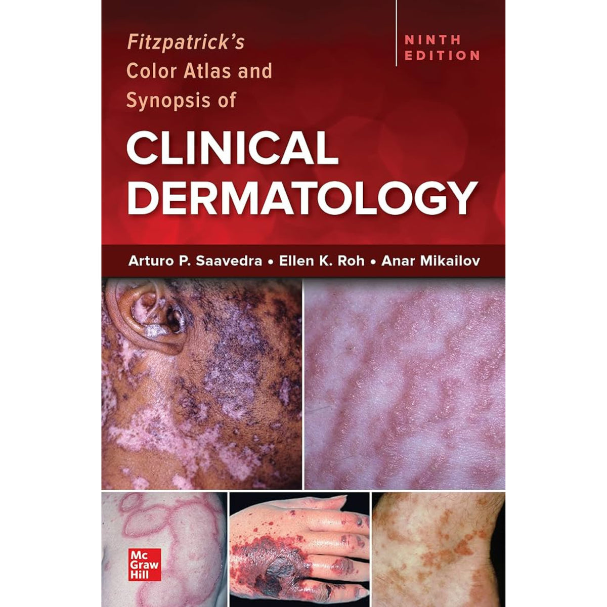 Fitzpatrick’s color atlas and synopsis of clinical dermatology 9e