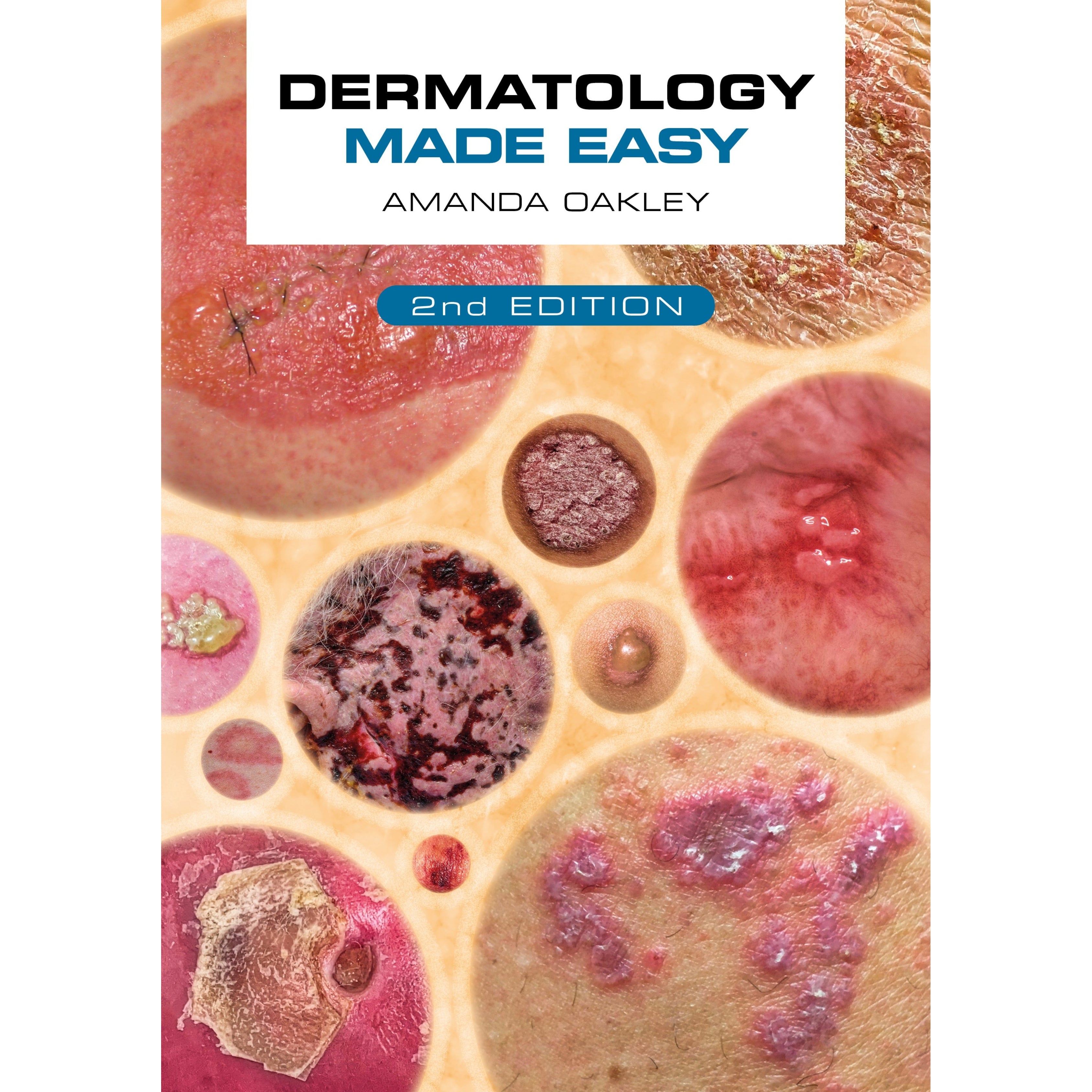 Dermatology made easy (color)