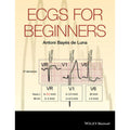ECG for beginners