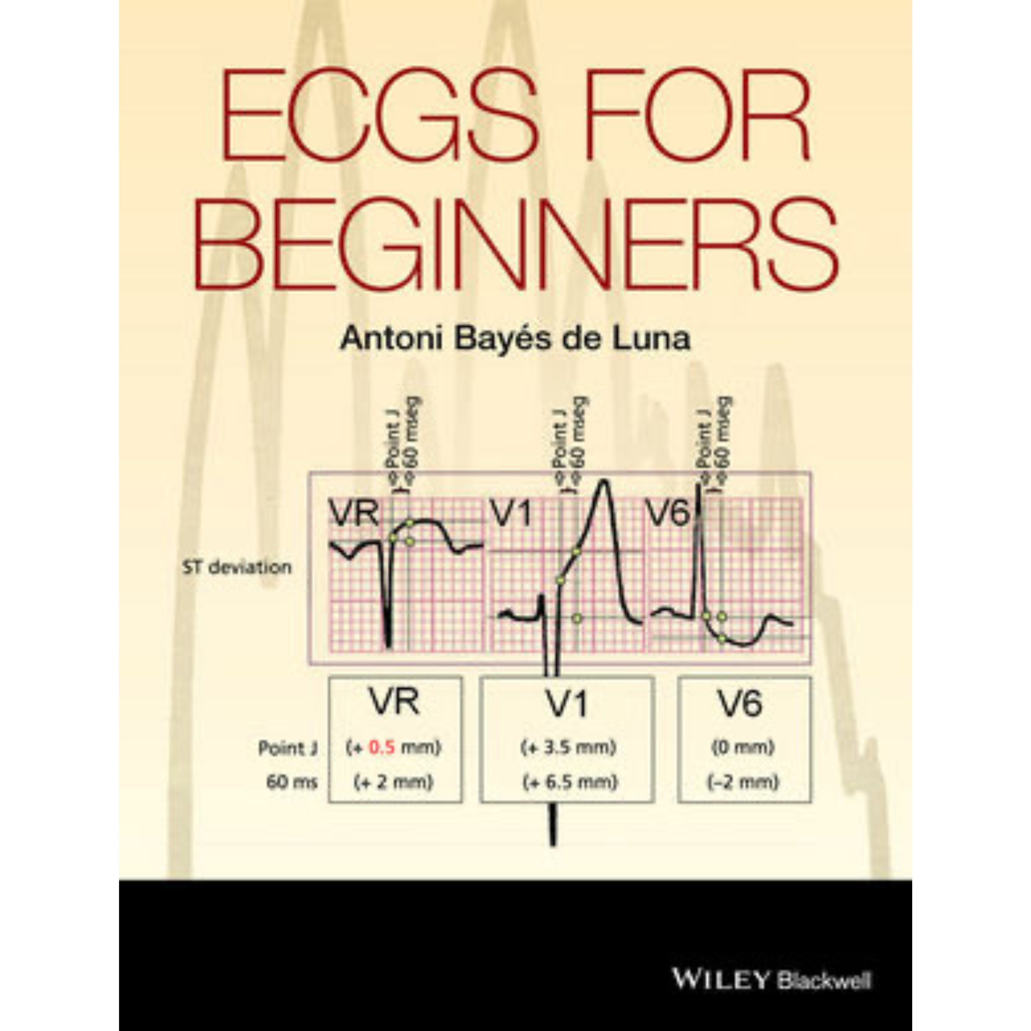 ECG for beginners